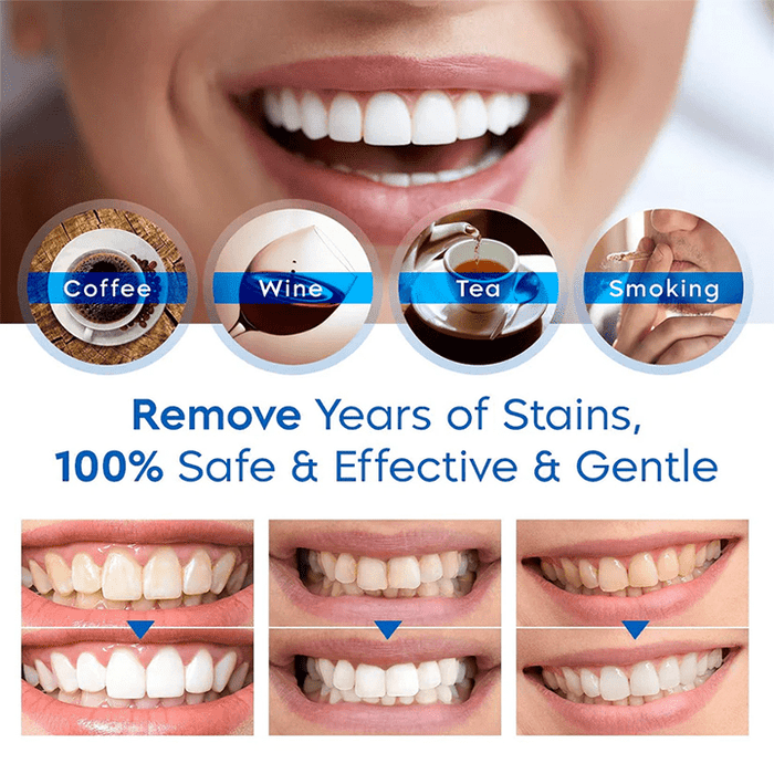 Oakly Teeth Whitening Solution