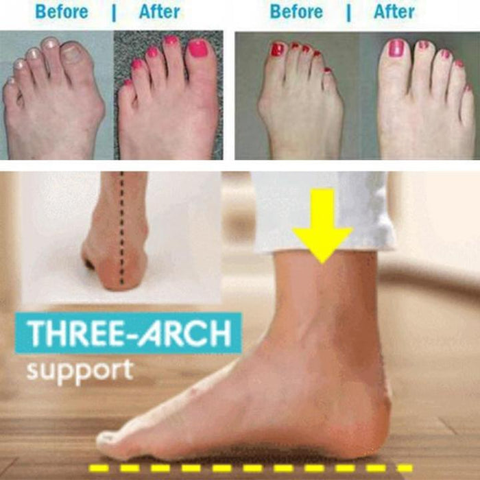 HealthySandals Orthopedic Toe Corrector Sandals
